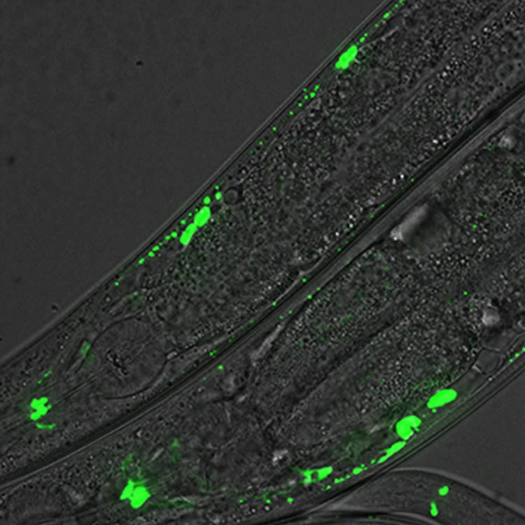 Image shows C.elegans neurons.