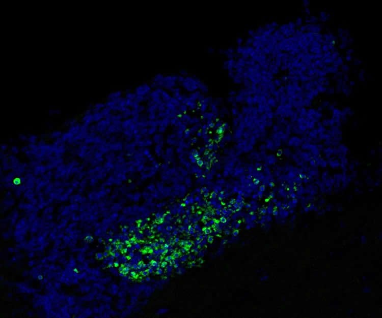 Image shows dead cells in the SVZ of a mouse brain.