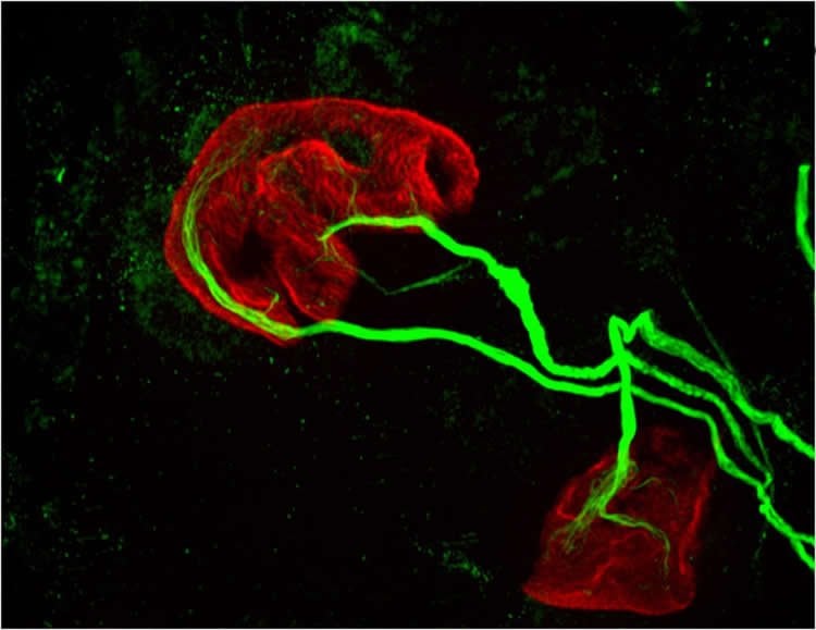 Image shows MCHI in motor neurons.