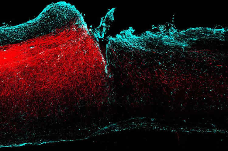 Image shows axons in the motor cortex.