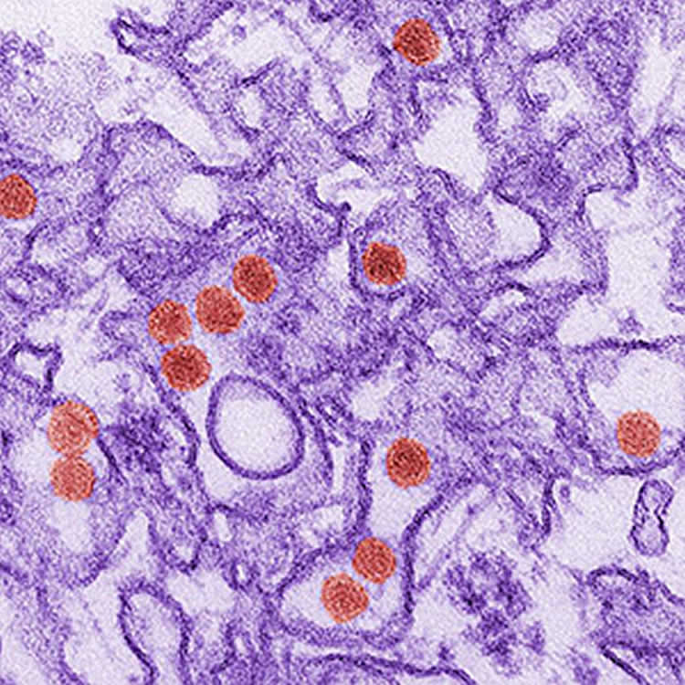 This is a digitally-colorized transmission electron micrograph (TEM) of Zika virus.