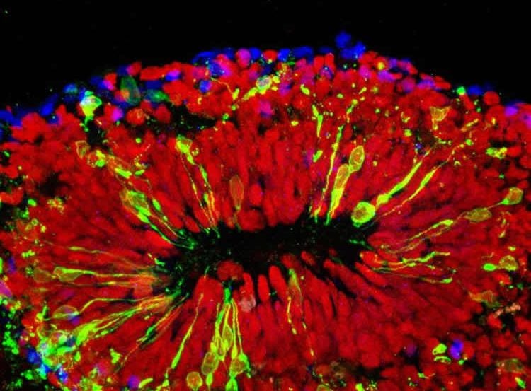 Image shows a mini brain infected with Zika virus.