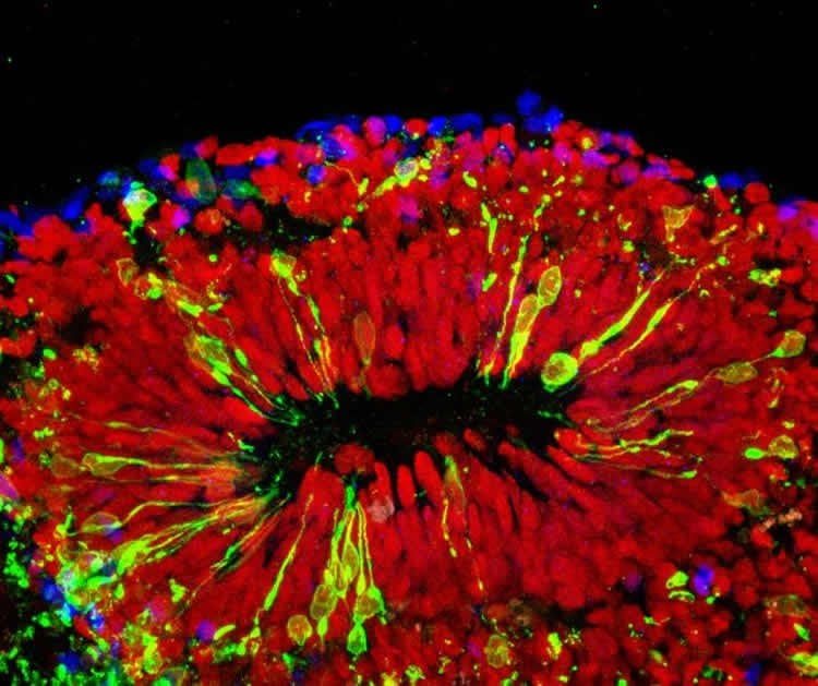 Image shows a mini brain infected with Zika virus.