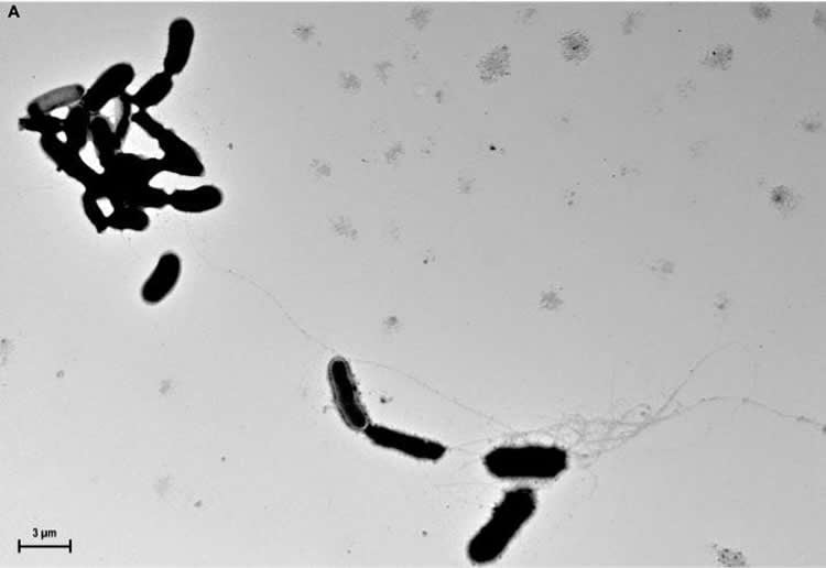 Image shows amyloid beta.