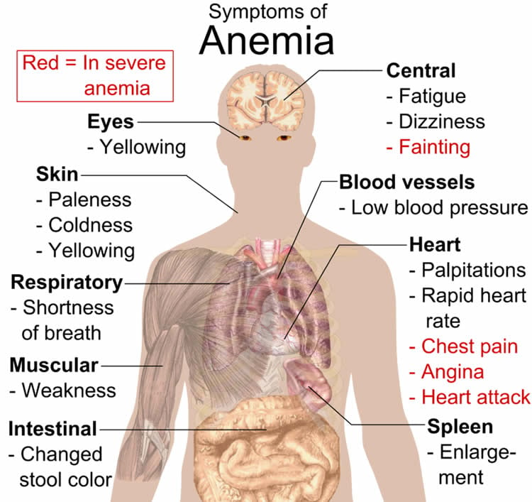 How Does Anemia Show Up On Blood Work