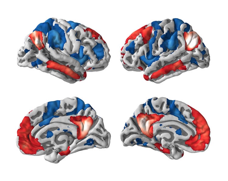 Image shows brain scans.