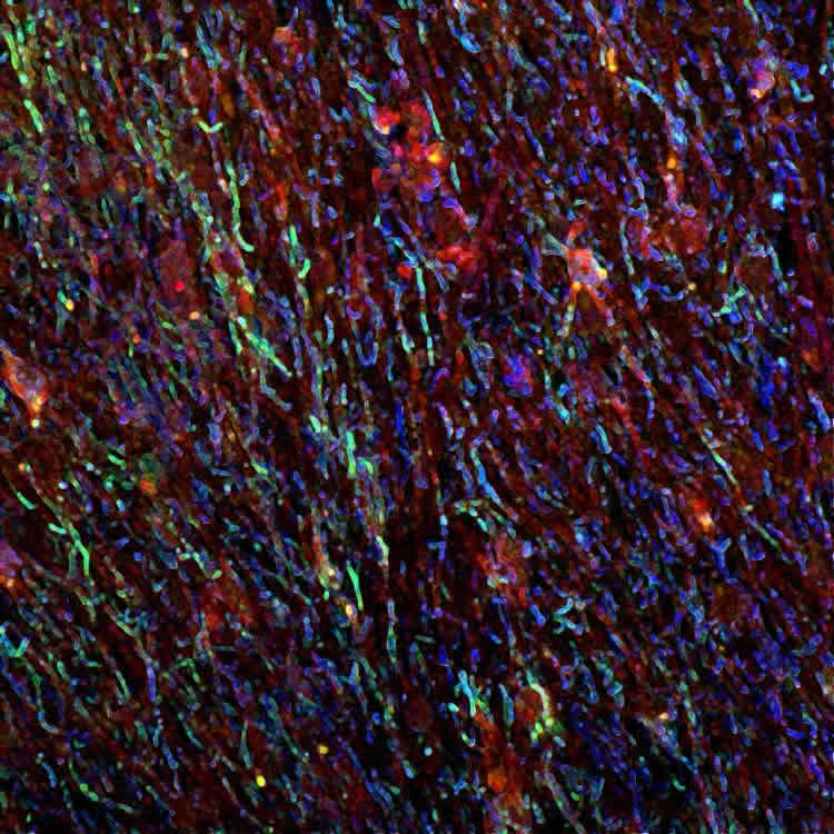 Image shows brain tissue.