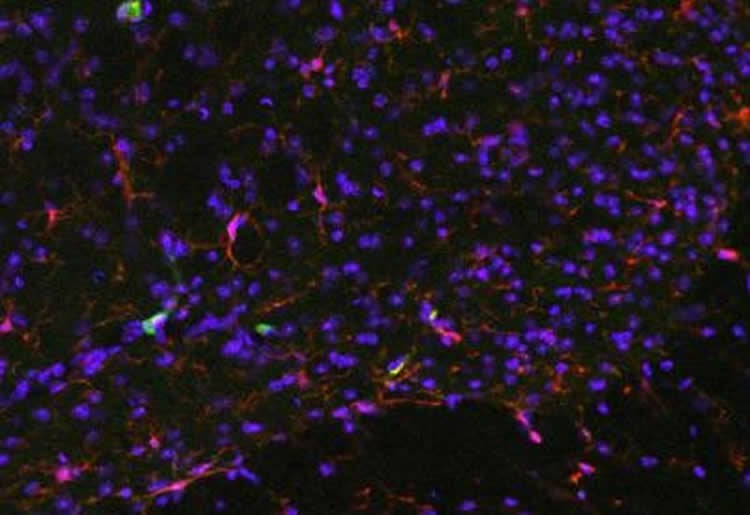 Image shows microglia.