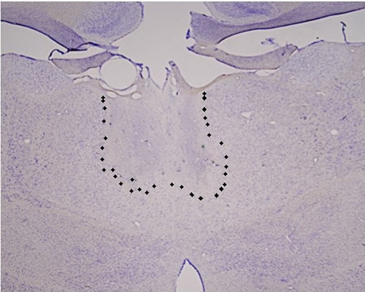 Image shows the location of the mediodorsal thalamus.