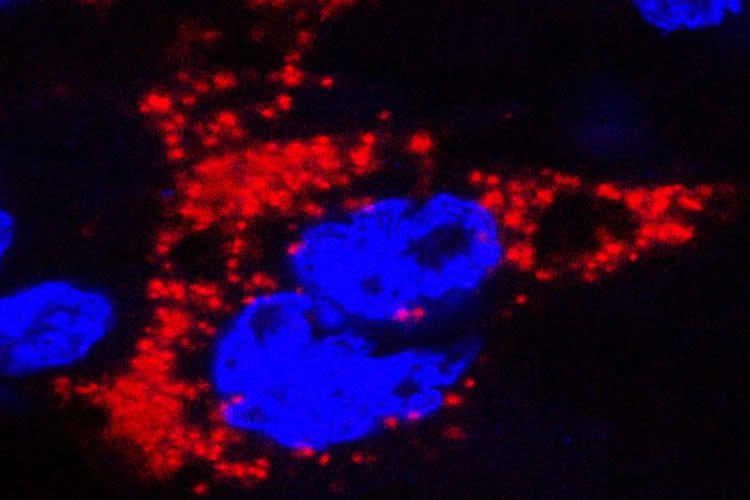 Image shows the Zika virus in a mouse placenta.