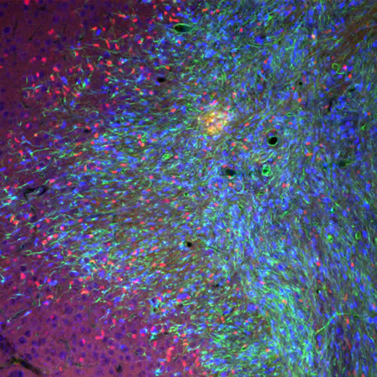 Image shows brain cells expressing Olig2.