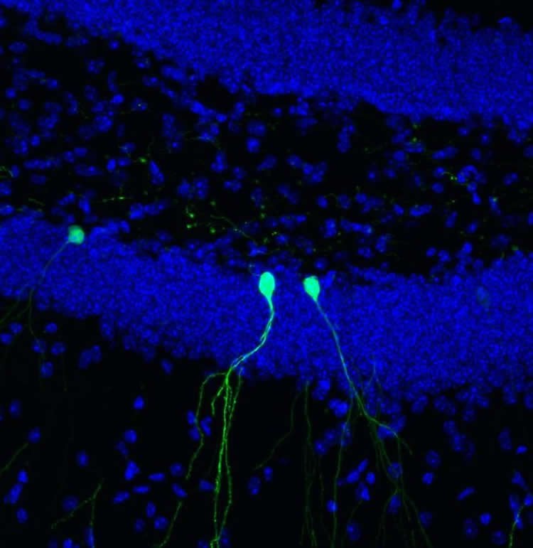Image shows neurons in the adult brain.