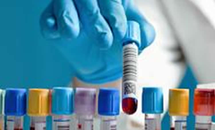 Image shows a blood samples.