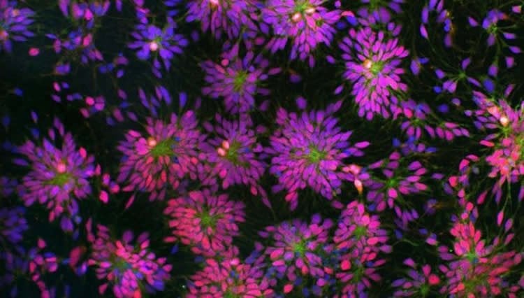 Image shows neural stem cells.