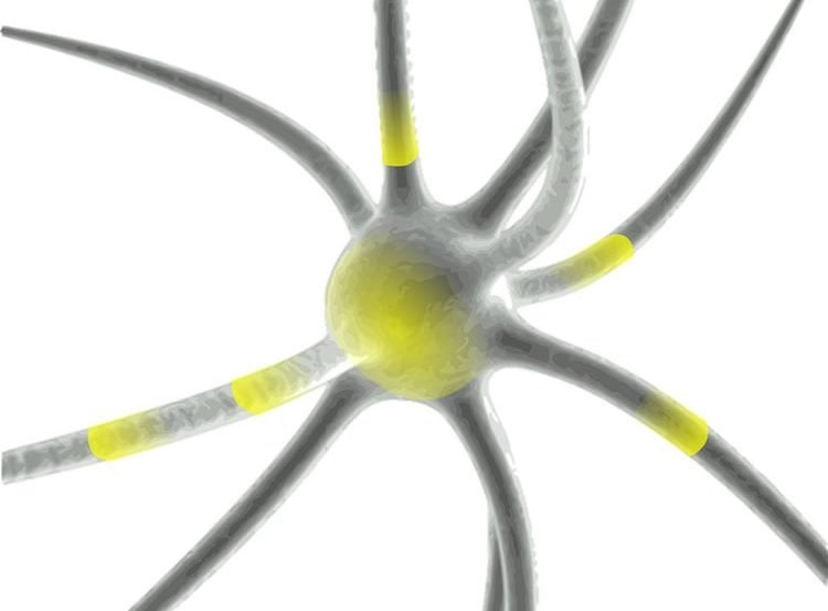 Image shows a neuron.