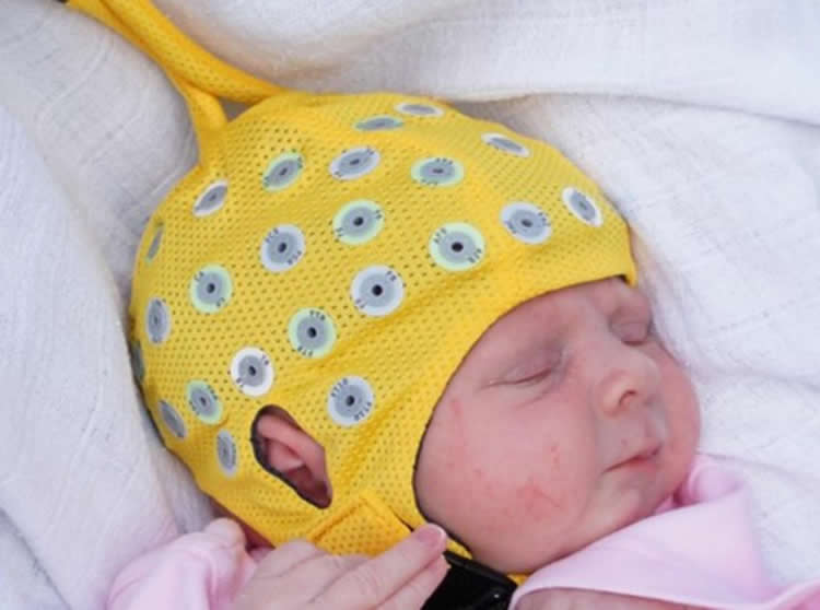 Image shows an baby in an eeg cap.