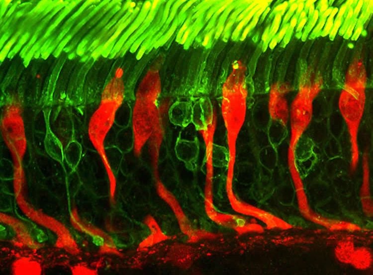 Image shows rods and cones in the retina.