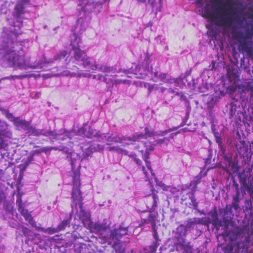 Image shows a cross section from a teratoma.