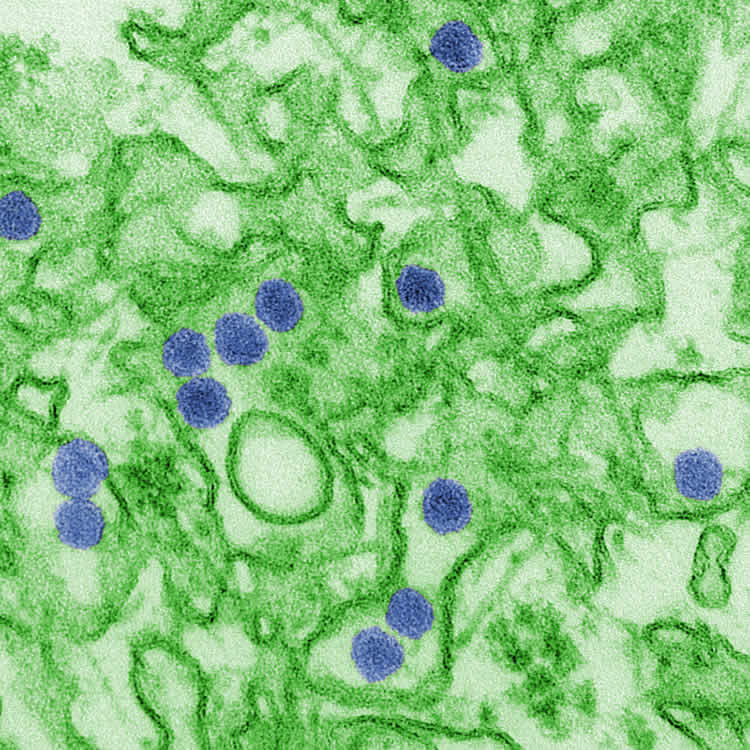 Image shows the zika virus.