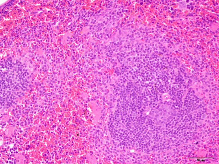 lymphoid tissue