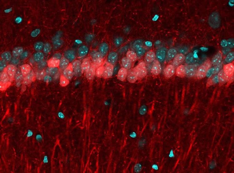 Image shows the CA1 hippocampal area of a mouse brain.