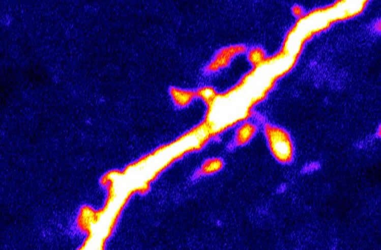 Image shows dendritic spines on a neuron.