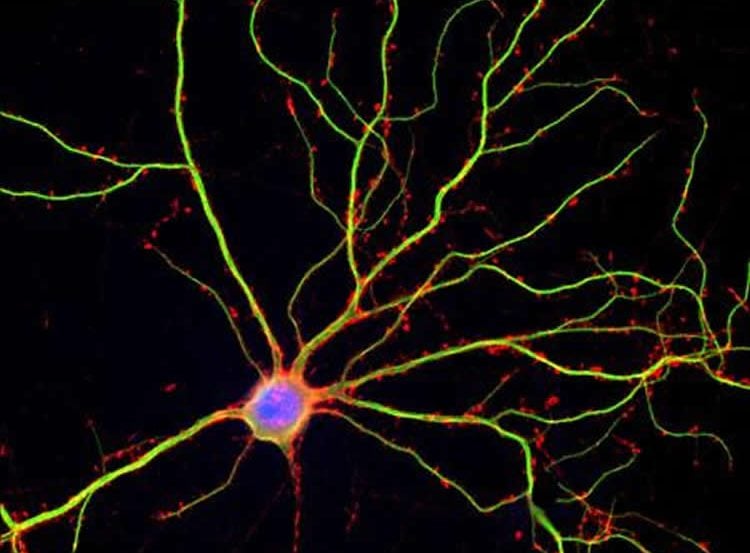 Image shows a hippocampal neuron.