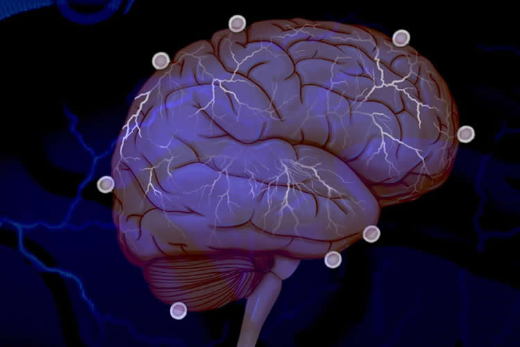 Image shows a brain.