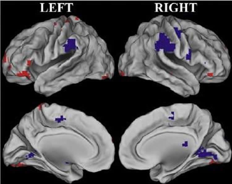 Image shows brain scans.