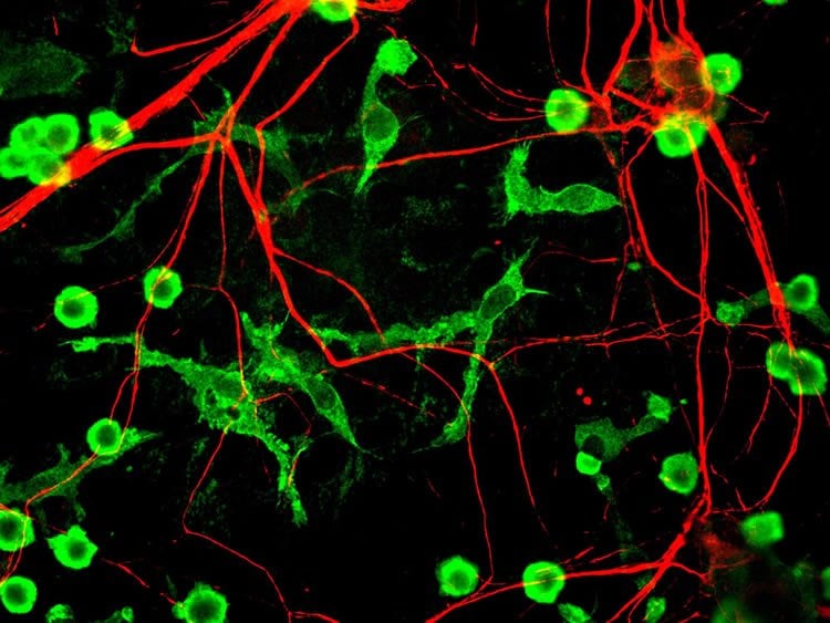 Image shows neurons and microglia.