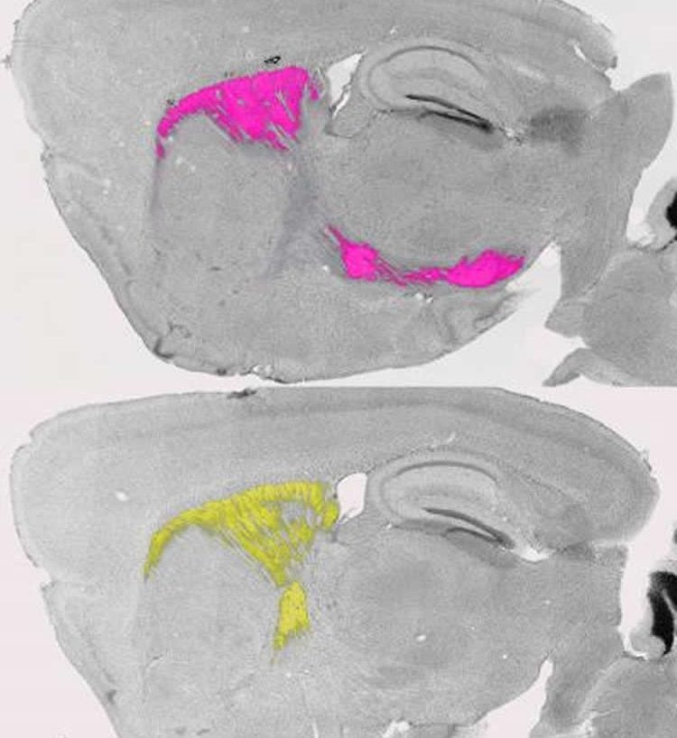Image shows the basal ganglia of a mouse.