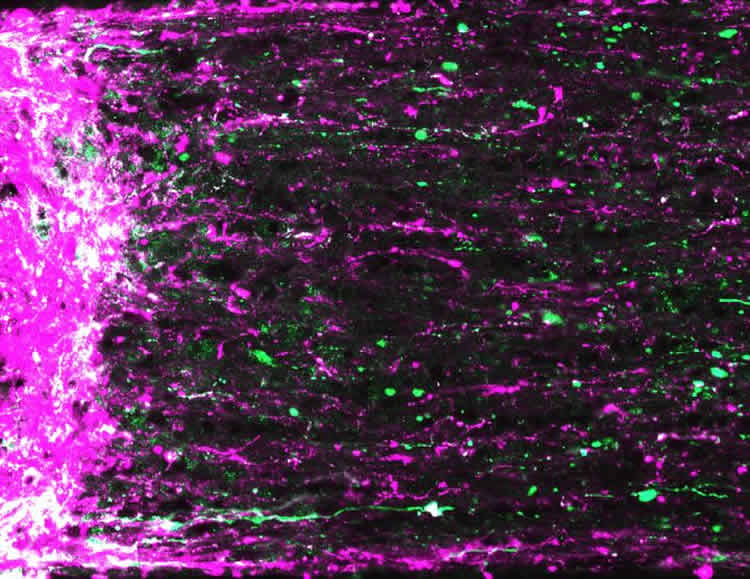 Image shows retianl ganglion cells.