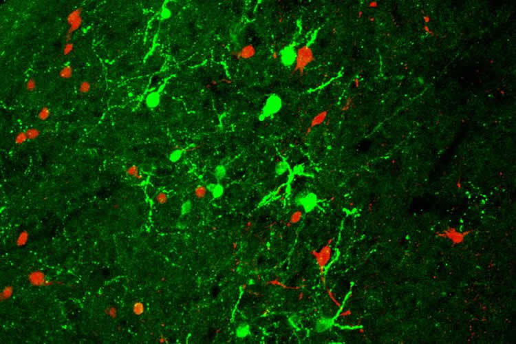 Image shows urocortin 3 in a mouse brain.