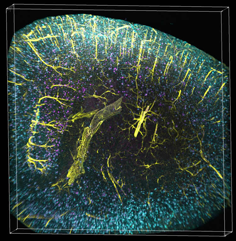 Image shows vasculature, glia cells, and plaques.