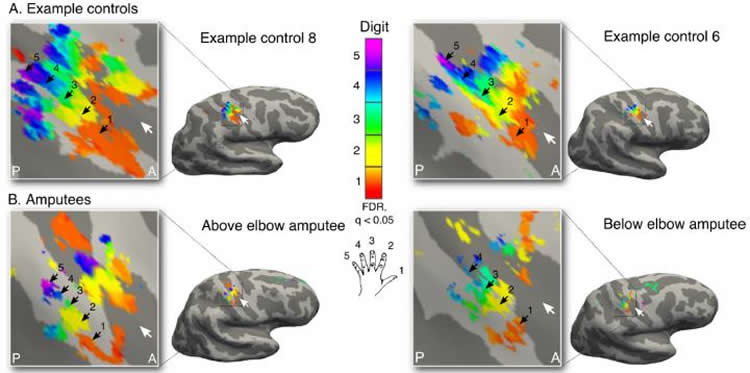 Image shows brain maps.