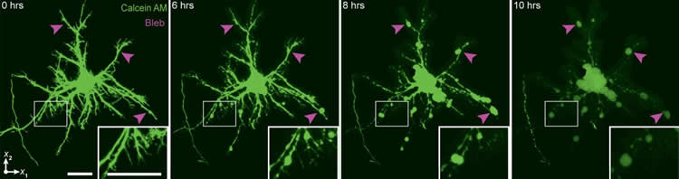 Image shows neurons images by the new technique.