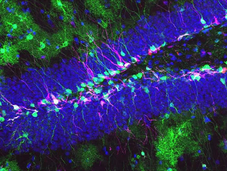 Image shows neural stem cells in the hippocampus.