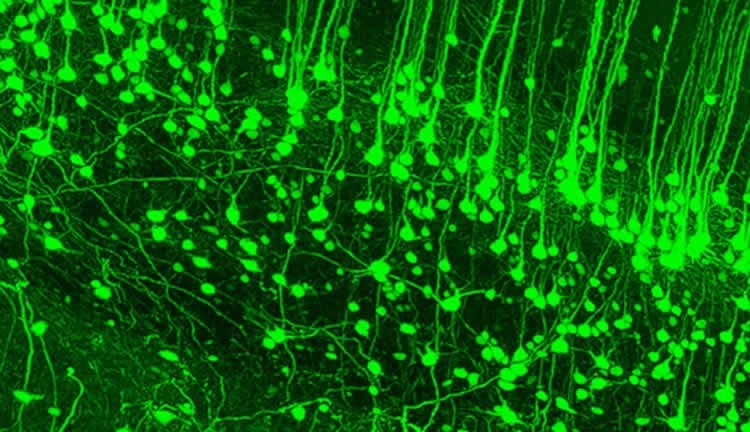 Image shows neural stem cells.