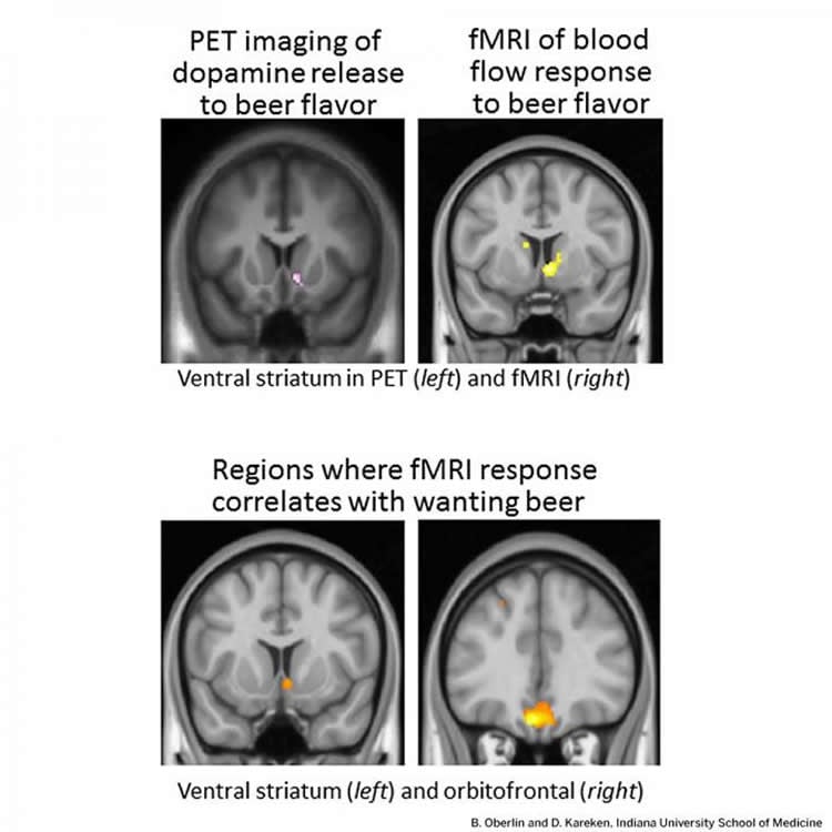 Image shows brain scans.