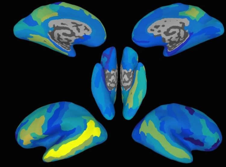 Image shows brain maps with the areas of prediction highlighted.