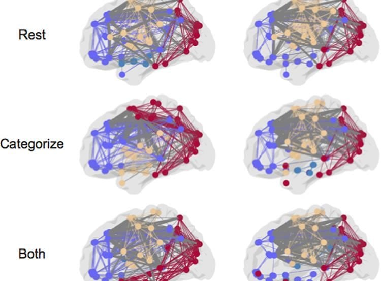 Image shows brain networks.