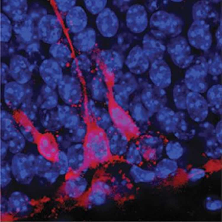 Image shows hippocampal neurons.