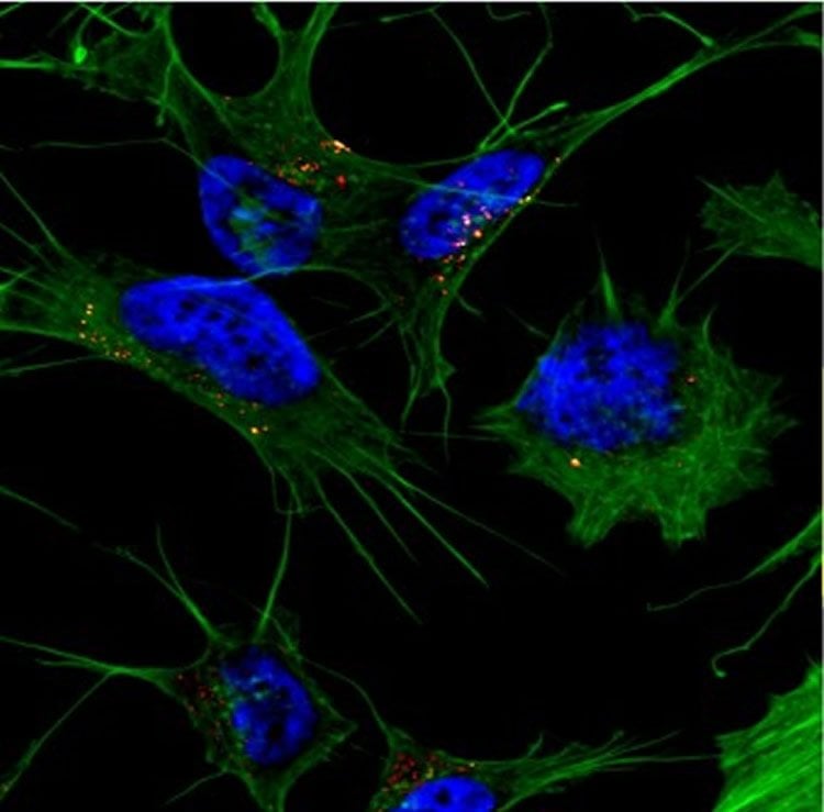 Image shows amyloid beta.