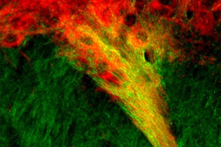 Image shows dopamine producing neurons in the SN.