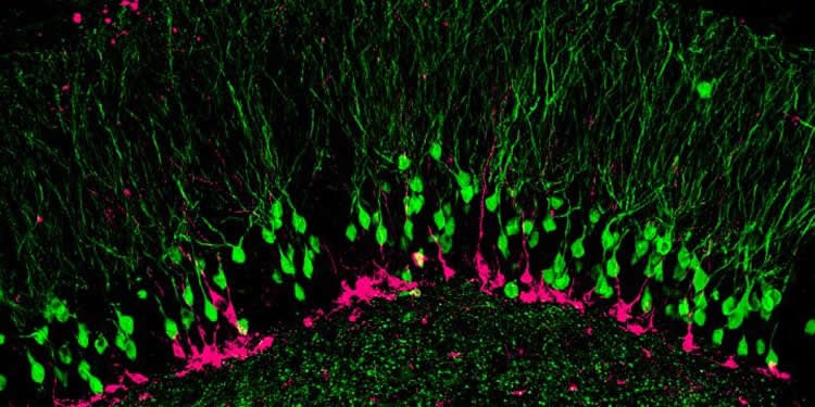 Image shows hippocampal neurons.