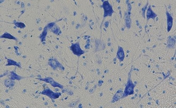 Image shows motor neurons.