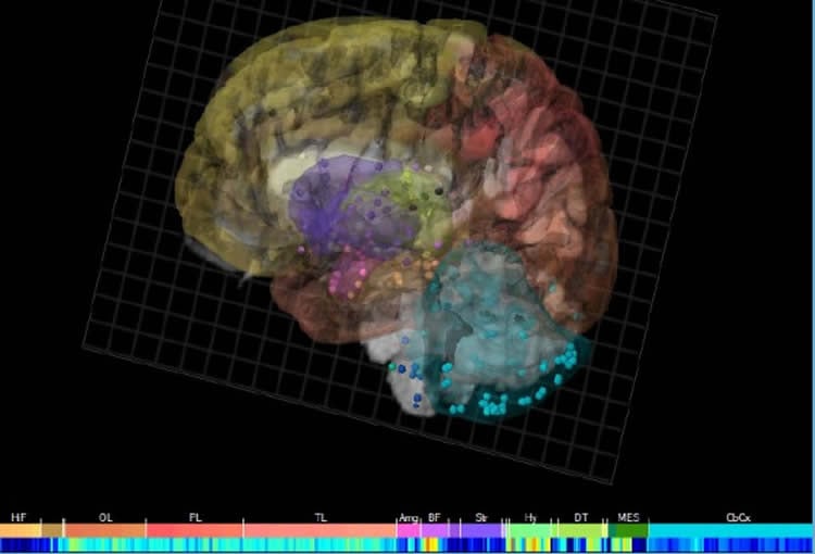 Image shows neuroglobin expression in the brain.