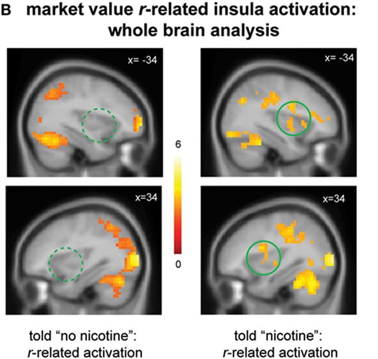 Image shows brain scans from the study.