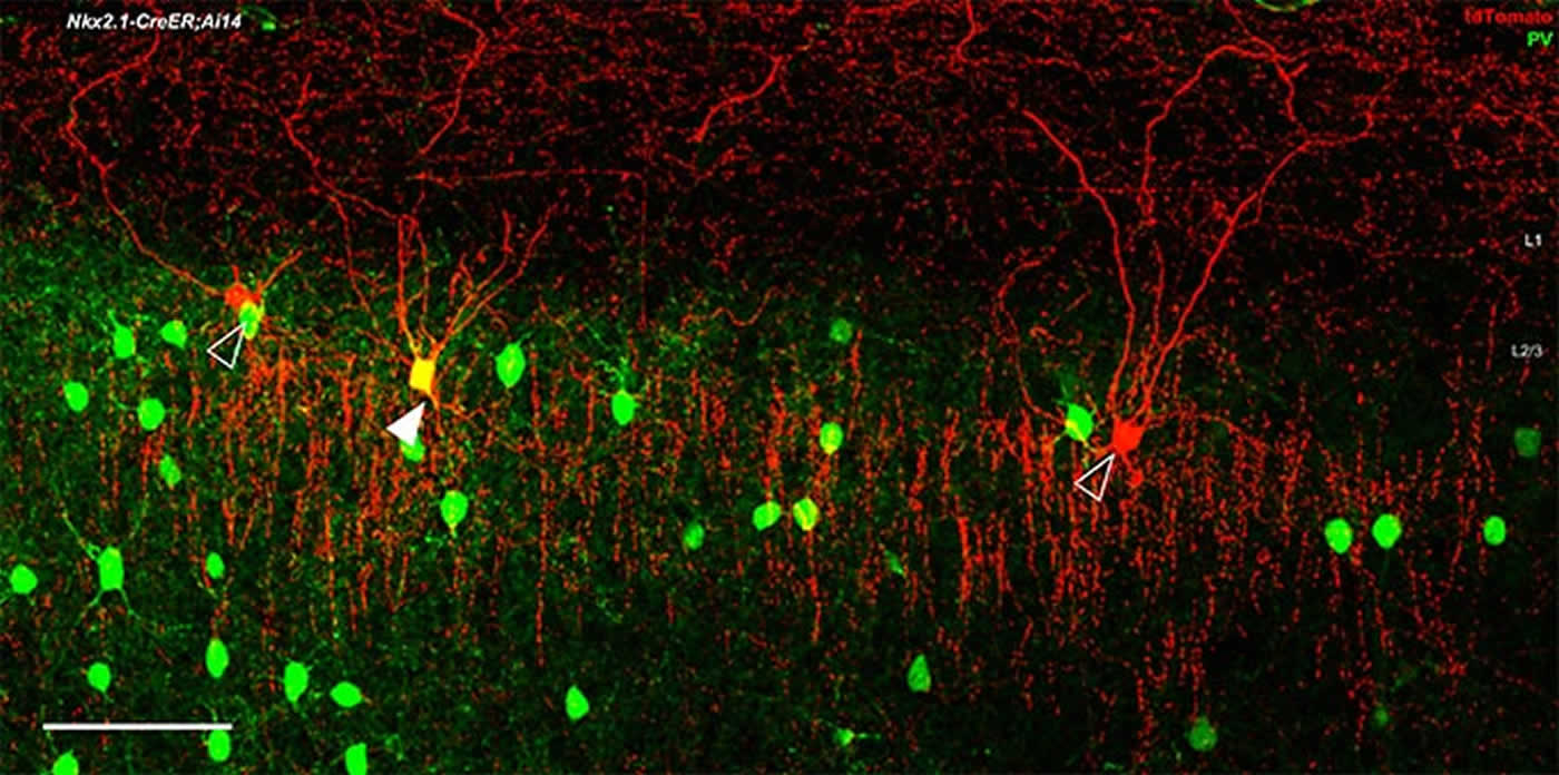 Image shows PV interneurons.