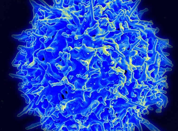 Image shows a T cell.